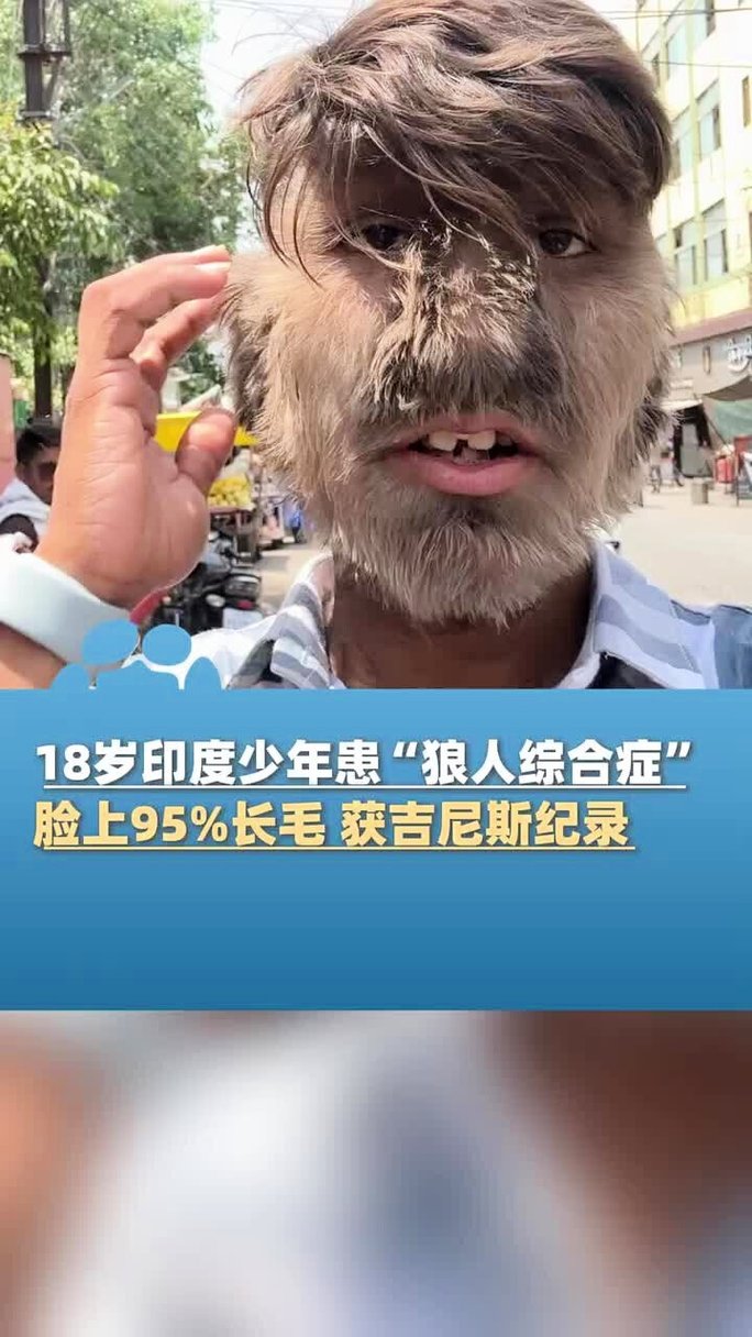 曰本真人性做爰视频极限影院的相关介绍